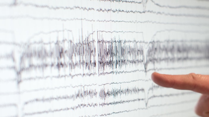 Eine Hand zeigt auf einen Kontrollmonitor, der die Gehirnströme von einem Epilepsie-Patienten anzeigt