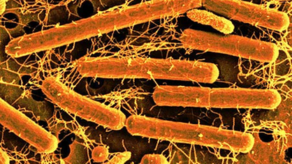 Elektronenmikroskopische Aufnahme von Milchsäurebakterien (Lactobacillus acidophilus), die orange eingefärbt wurden.