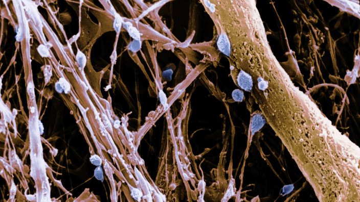 Elektronenmikroskopaufnahme des Hypothalamus mit Parenchymen und Neuronen